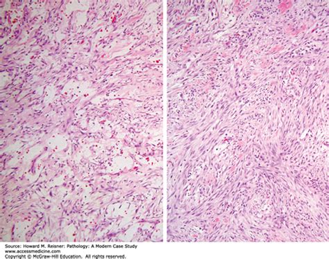 Soft Tissue And Bone Pathology Basicmedical Key