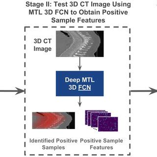 Artificial Intelligence AI Based Medical Image Segmentation For 3D