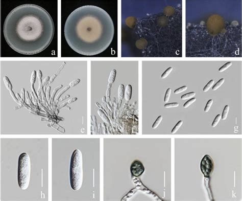 South China Fungi Colletotrichum Siamense