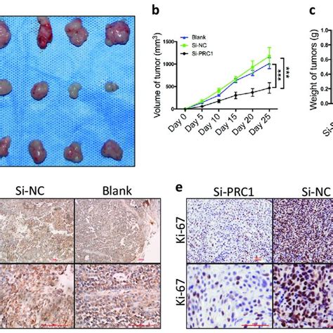 Downregulation Of PRC1 Inhibits Tumor Growth In Vivo A Gross Tumors