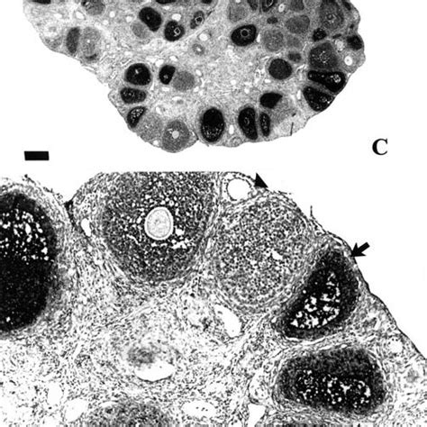 Sex Steroid Regulation Of Ovarian Apoptosis In Situ 3′ End Labelling