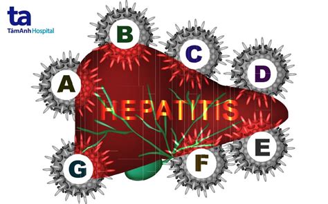 Bệnh viêm gan Triệu chứng nguyên nhân gây bệnh và chẩn đoán