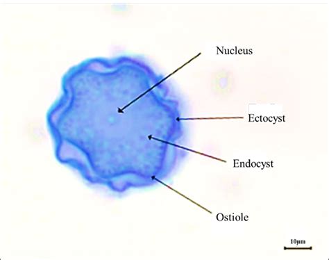 Acanthamoeba Cyst Morphology