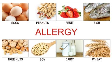 Understanding Food Allergies During Allergy Awareness Week The Best