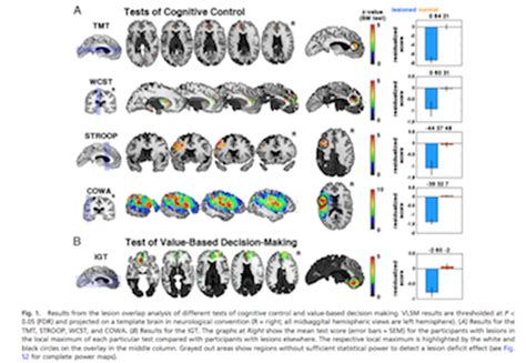 STUDY ALERT: Lesion mapping of cognitive control and value-based ...