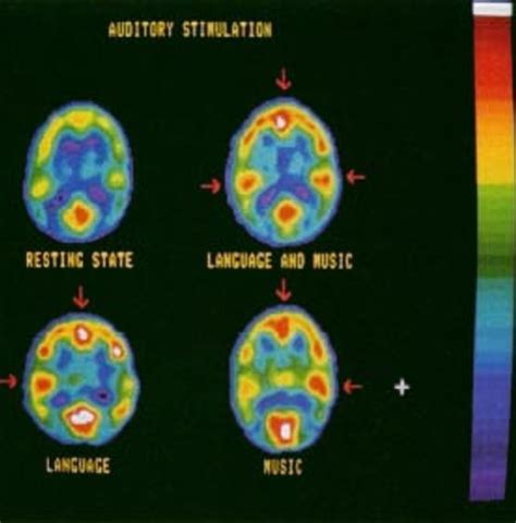 Les Bienfaits Insoupçonnés Du Chant Lunivers De La Musique Et Des