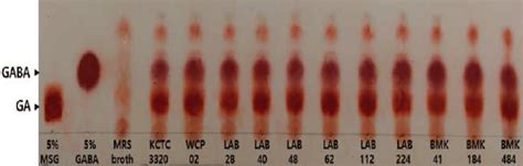 Thin Layer Chromatography TLC Profiles Of GA And GABA Standards And