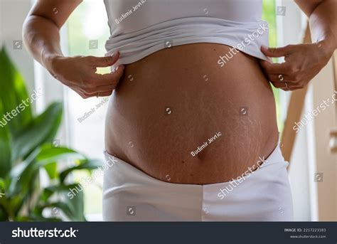 Close Naked Pregnant Woman Belly Stretch Stock Photo Shutterstock