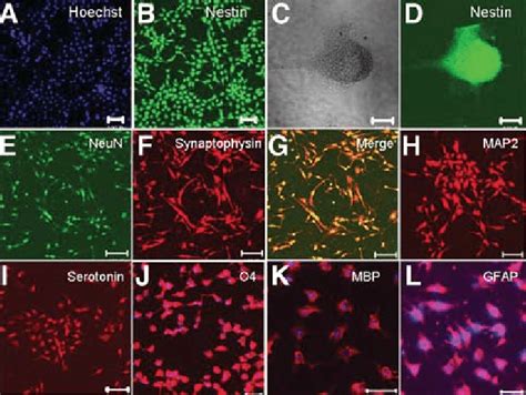 Immunocytochemical Characterization Of Undifferentiated And