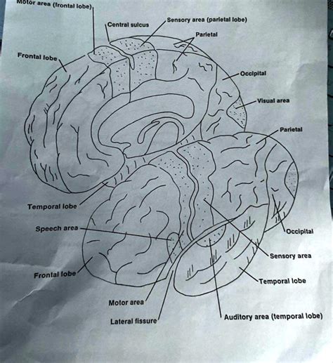 SOLVED: List of Functions: 1. Motor area (frontal lobe) 2. Sensory area (parietal lobe) 3 ...