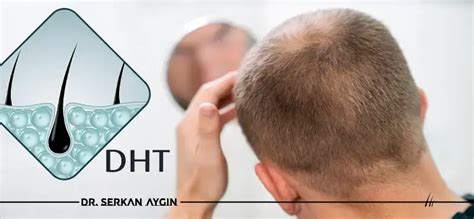 Dht E Queda De Cabelo - Queda de Cabelo por DHT: Causas, Prevenção e Recuperação