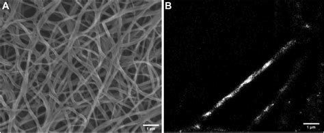 What Is The Diameter Of A Fibrin Fiber Research And Practice In