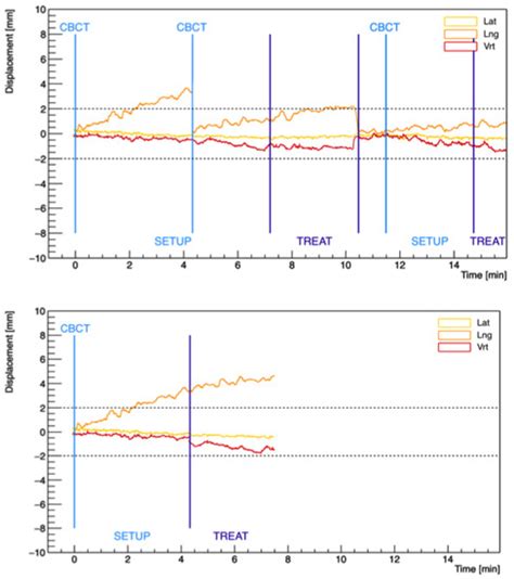 Cancers Free Full Text Dosimetric Impact Of Intrafraction Prostate Motion And Interfraction