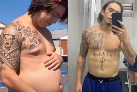 Whindersson Nunes Emagrece 32 Kg Antes E Depois Choca A Web Confira