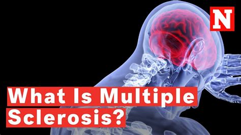 What Is Multiple Sclerosis Youtube