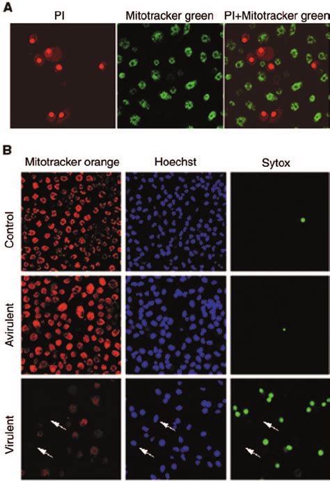 Mitochondrial Membrane Potential Is Altered In Monocyte Derived