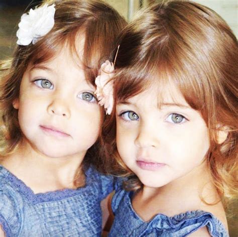 They called them the world’s most beautiful twins 10 years ago – but ...