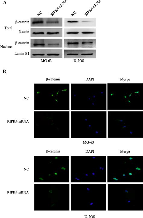 Silencing of RIPK4 suppresses the inactivation of the Wnt β catenin