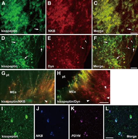 Colocalization Of Kisspeptin Nkb And Dyn In The Caudal Arc And Me Of