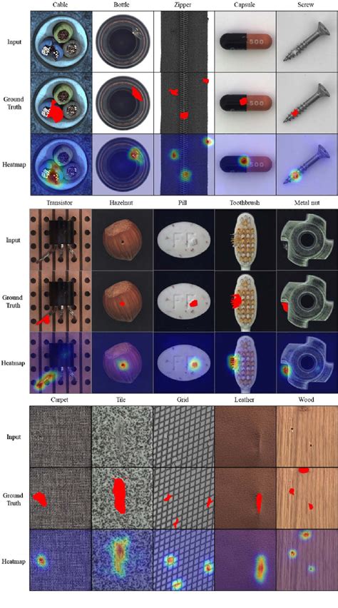 Figure From Self Supervised Image Anomaly Detection And Localization