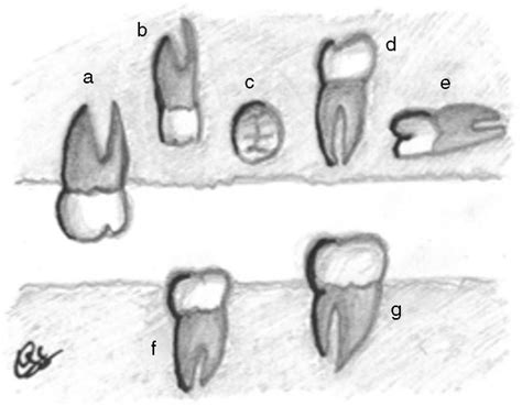 Ilustraci N De Los Tipos De Orientaci N De Un Sn A Vertical