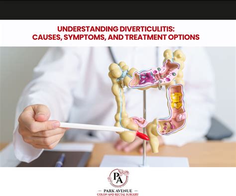 Understanding Diverticulitis Causes Symptoms And Treatment Options