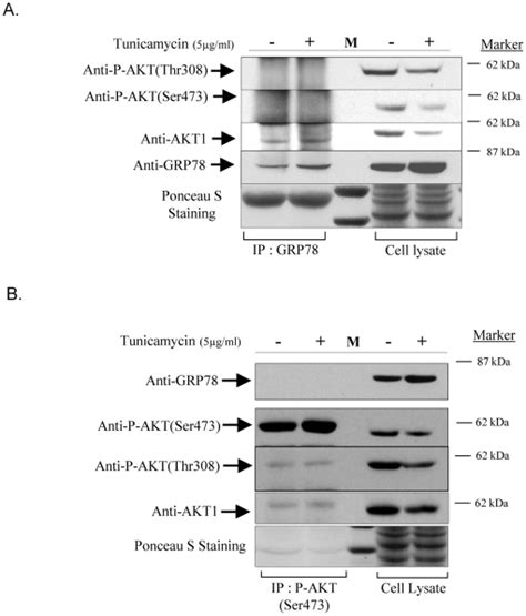 A Loss Of Akt Phosphorylation At Ser473 And Thr308 In The Grp78 Ip Download Scientific Diagram