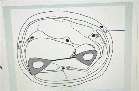 Solved Identify The Structure That Is Flagged By The Blue Chegg