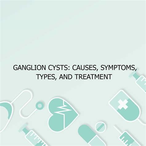 Ganglion Cysts Causes Symptoms Types And Treatment