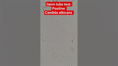 Germ Tube Test Positive Candida Albicans Youtube