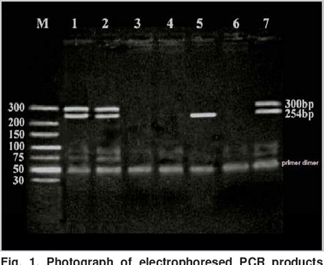 Figure 1 From Rapid Sex Determination Using Pcr Technique Compared To Classic Cytogenetics