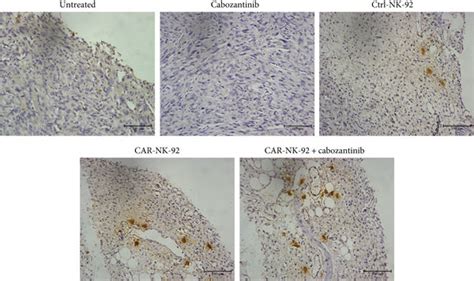 Tumor Infiltration Analysis Of Nk 92 Cells In Vivo A Download