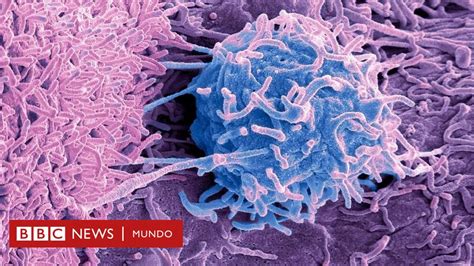 Cáncer El Misterio De Los Microbios Que Viven Dentro De Los Tumores Bbc News Mundo