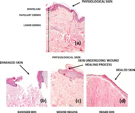 [PDF] Skin Wound Healing Process and New Emerging Technologies for Skin ...