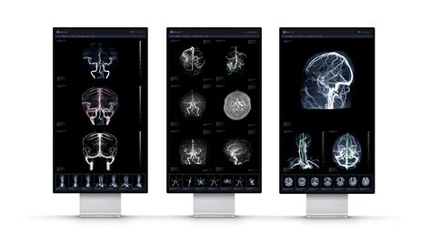 Eirlエイル Ai画像診断支援技術 エルピクセル株式会社 Eirl（エイル）は、ct Mri 病理画像などの医療画像を