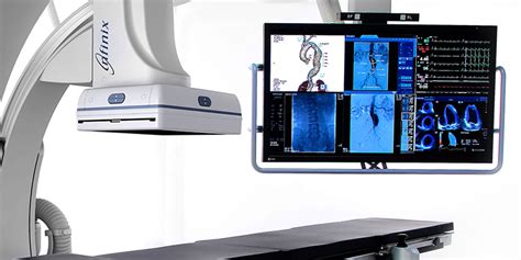 Infinix I Clinical Gallery Angiography Canon Medical Systems Usa