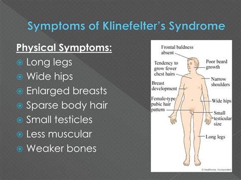 Ppt Klinefelter’s Syndrome Powerpoint Presentation Free Download Id 6593171