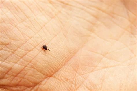 Lyme Disease Treatment In Chapel Hill Integrative Medical Clinic Of Nc