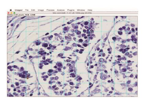 A Morphometric Analysis Of The Seminiferous Tubules And Leydig Cells