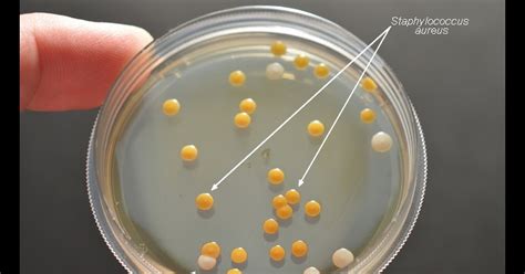 Merlins Micro World Staphylococcus Aureus Morphology Cultural