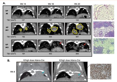 Figure 3 From A Quantitative Volumetric Micro Computed Tomography