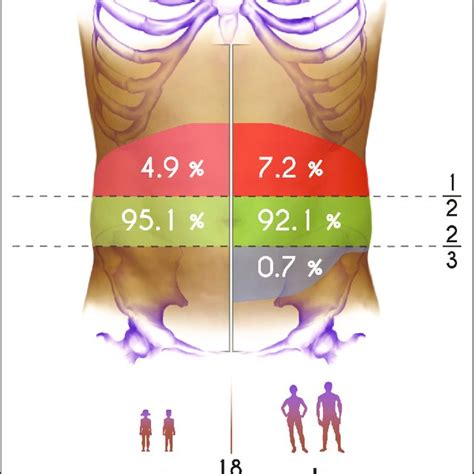 Repartition Of The Different Positions Of The Umbilicus On The