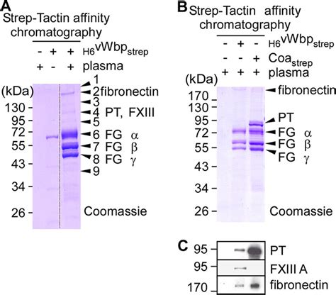 Identification of vWbp ligands isolated from human plasma and ... 
