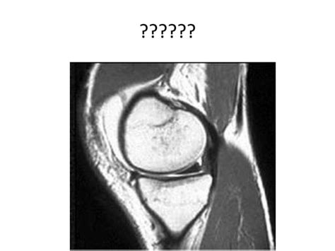 MRI protocol of Knee | PPT