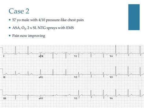 PPT - Wellens ’ Syndrome PowerPoint Presentation, free download - ID ...