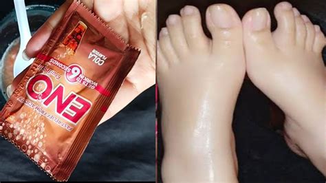 Foot Whitening Bleach Darkness