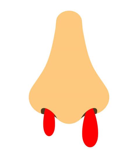 Nose Bleed Clip Art Illustrations, Royalty-Free Vector Graphics & Clip ...