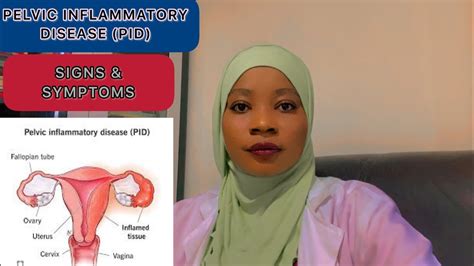 Pelvic Inflammatory Disease Pid And Infertility Signs And Symptoms What To Do Youtube