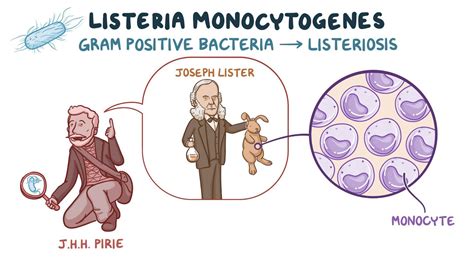 Granulomatosis infantiseptica: What Is It, Treatment, and More | Osmosis