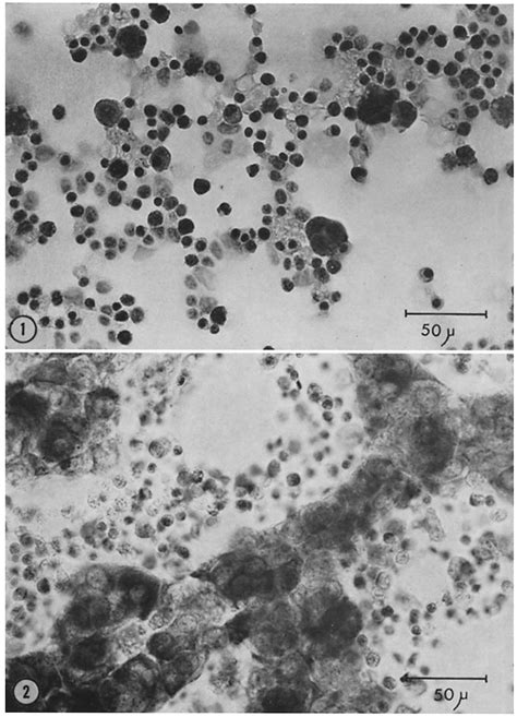 Trypsinized Preparation Of Embryonic Liver Hematoxylin And Eosin